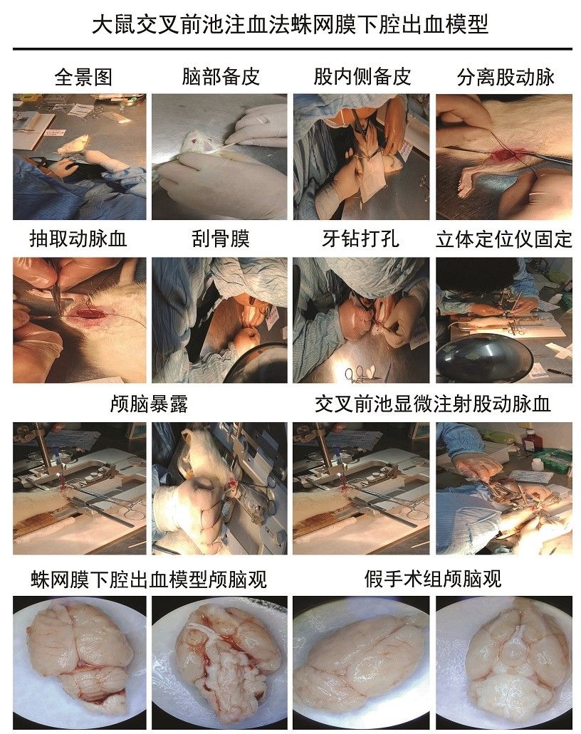 大鼠交叉前池注血法蛛網膜下腔出血模型